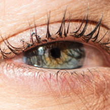 Zapalenie tęczówki oka – przyczyny, objawy i leczenie