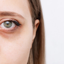 5 sposobów na przekrwione oczy, które działają!